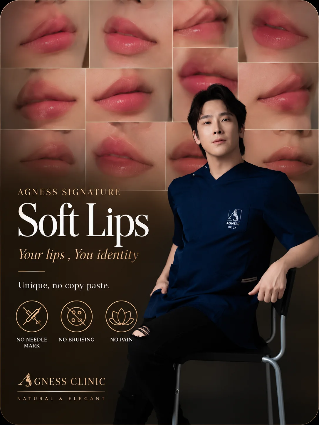 Agness Signature Soft Lips by Dr. CK at Agness Clinic Malaysia