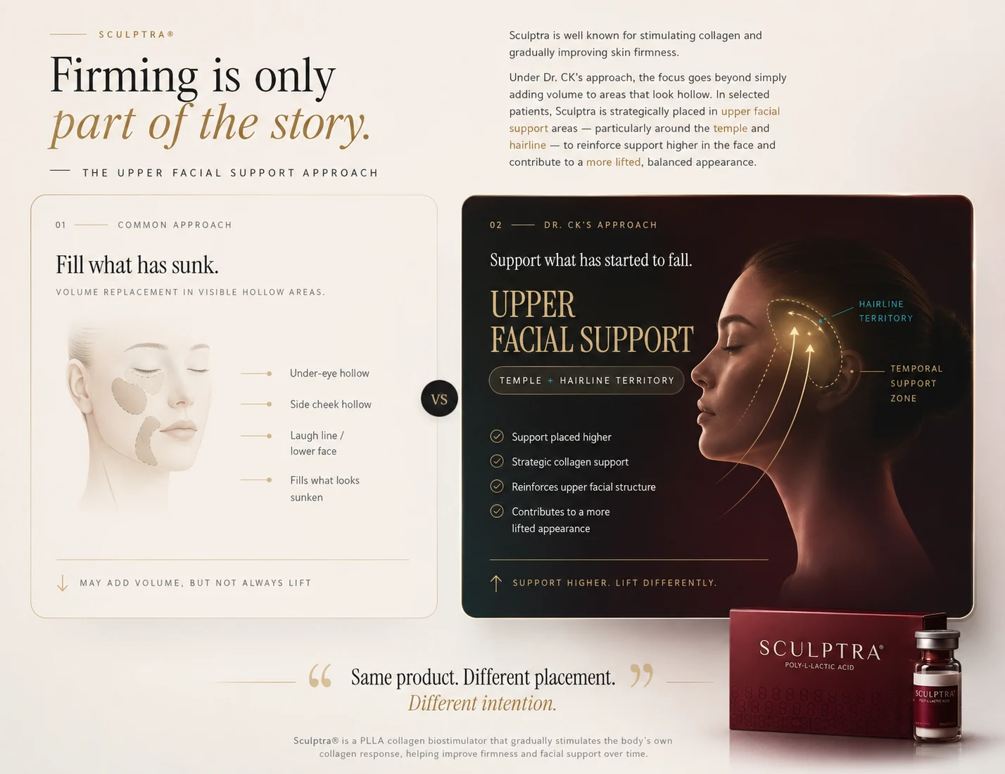 Sculptra upper facial support comparison showing conventional hollow-area volume replacement versus Dr. CK’s temple and hairline support approach at Agness Clinic.